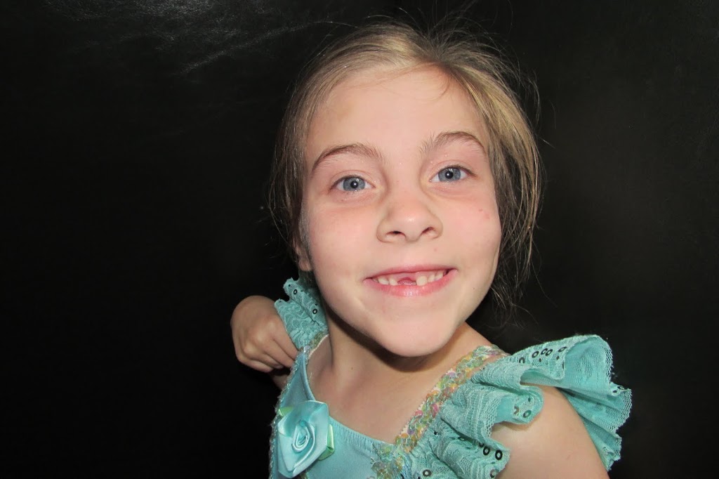 1st lost tooth